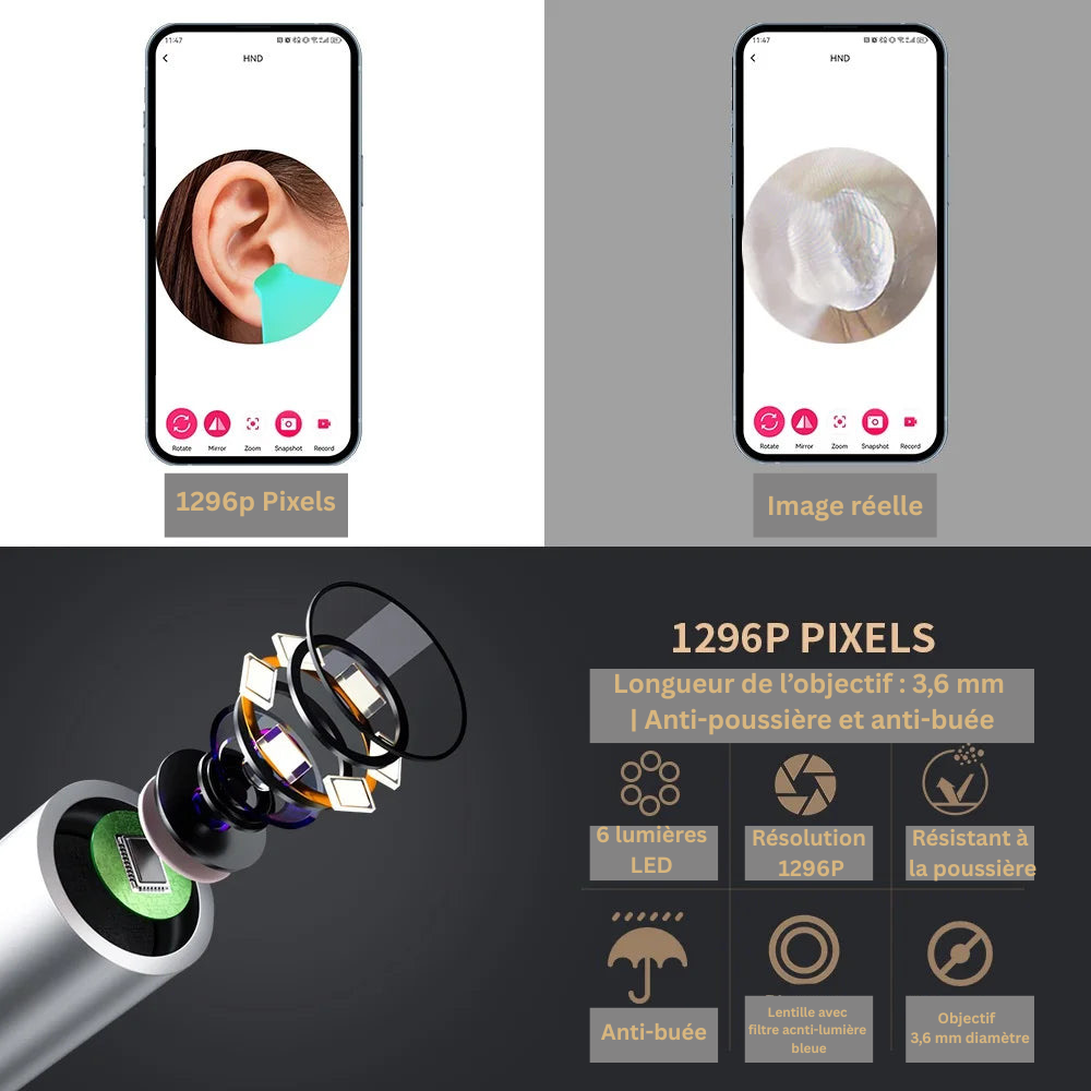 Healora VisionClean™ – Nettoyeur d'Oreille Intelligent HD